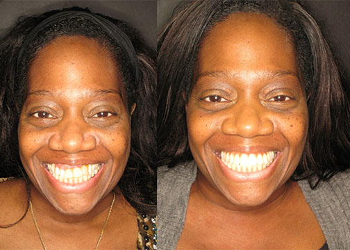PhD with Periodontitis and Fear of Dentistry