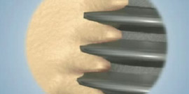 Dental Implant Healing Process