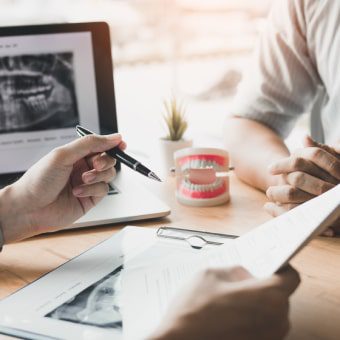 Zygomatic Dental Implants
