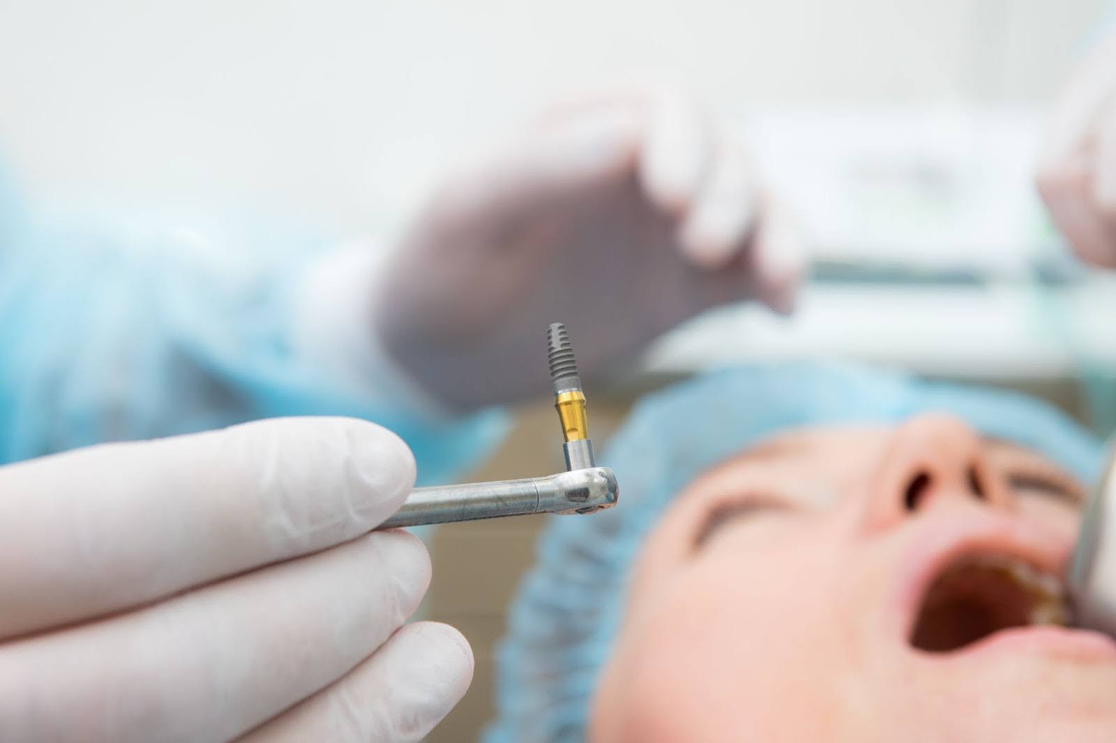 Dental Implant Removal Procedure